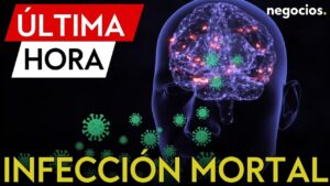 ÚLTIMA HORA | ALERTA SANITARIA EN EEUU: Una «ameba comecerebros» acaba con la vida de un adolescente